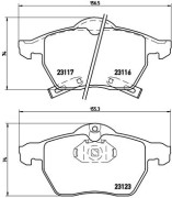   BREMBO P59 048
